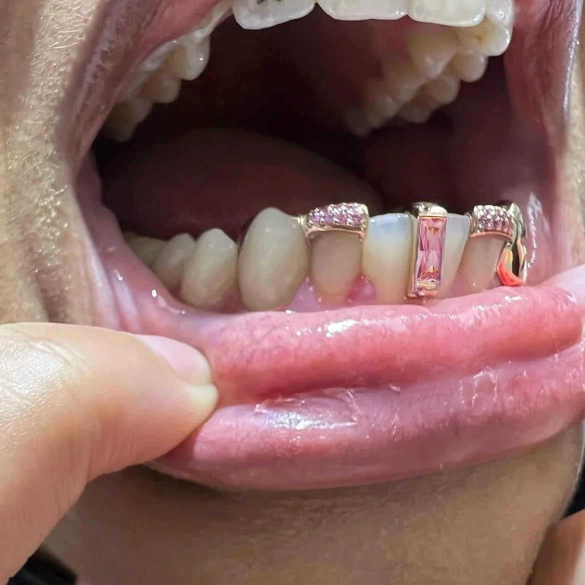 Precious Gems Tooth Grillz