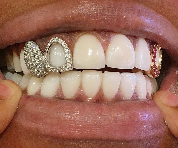 Iced Dual Tooth and Arrow Grillz
